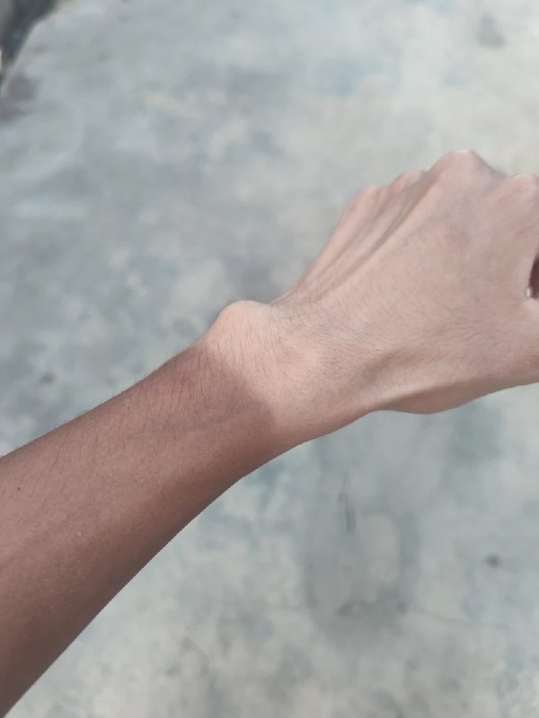 #吐槽注意防晒via Nostr@cxplay